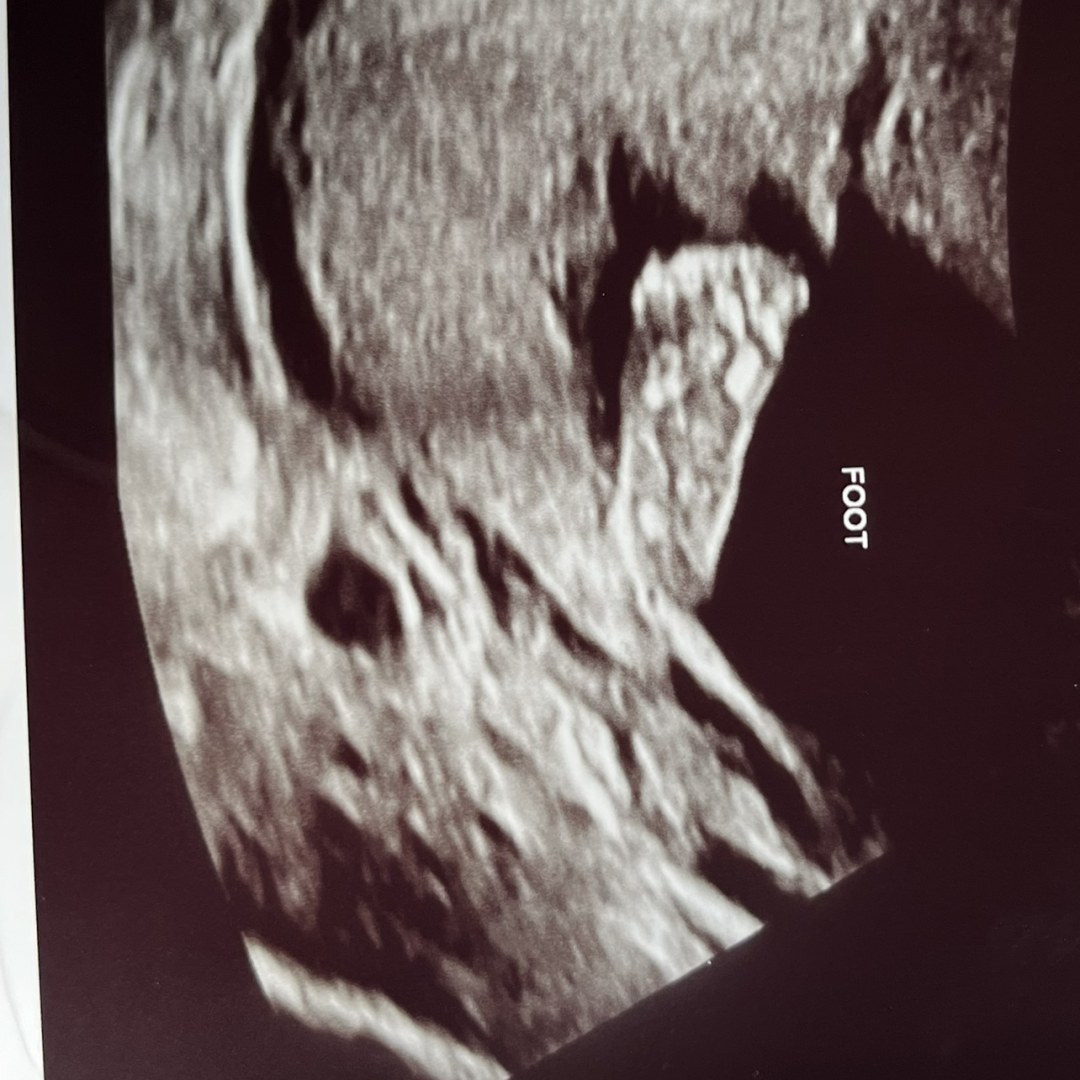 Photo shared by Elvira Marien for their Babylist baby registry.