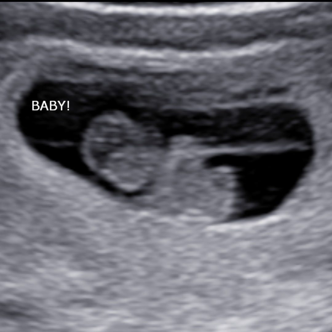 Photo shared by Morgan for their Babylist baby registry.