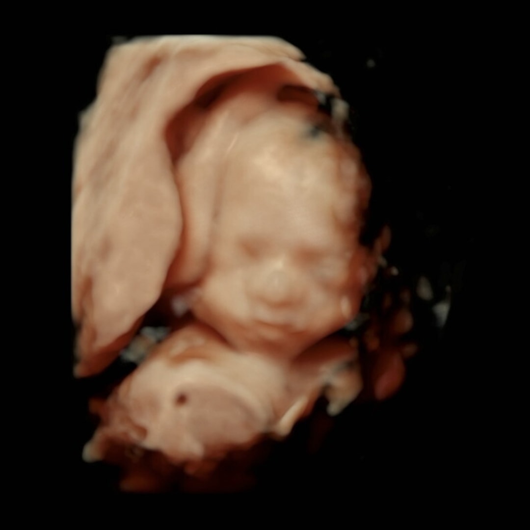 Photo shared by Alexis for their Babylist baby registry.