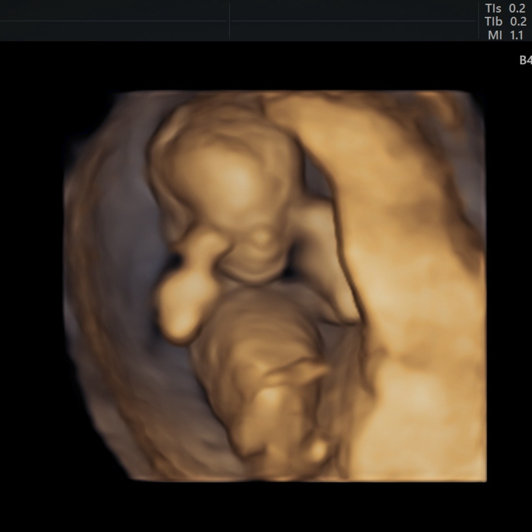 Photo shared by Nevaeh for their Babylist baby registry.