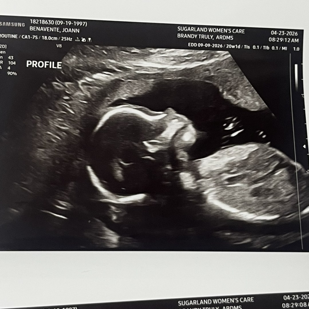 Photo shared by JoAnn for their Babylist baby registry.