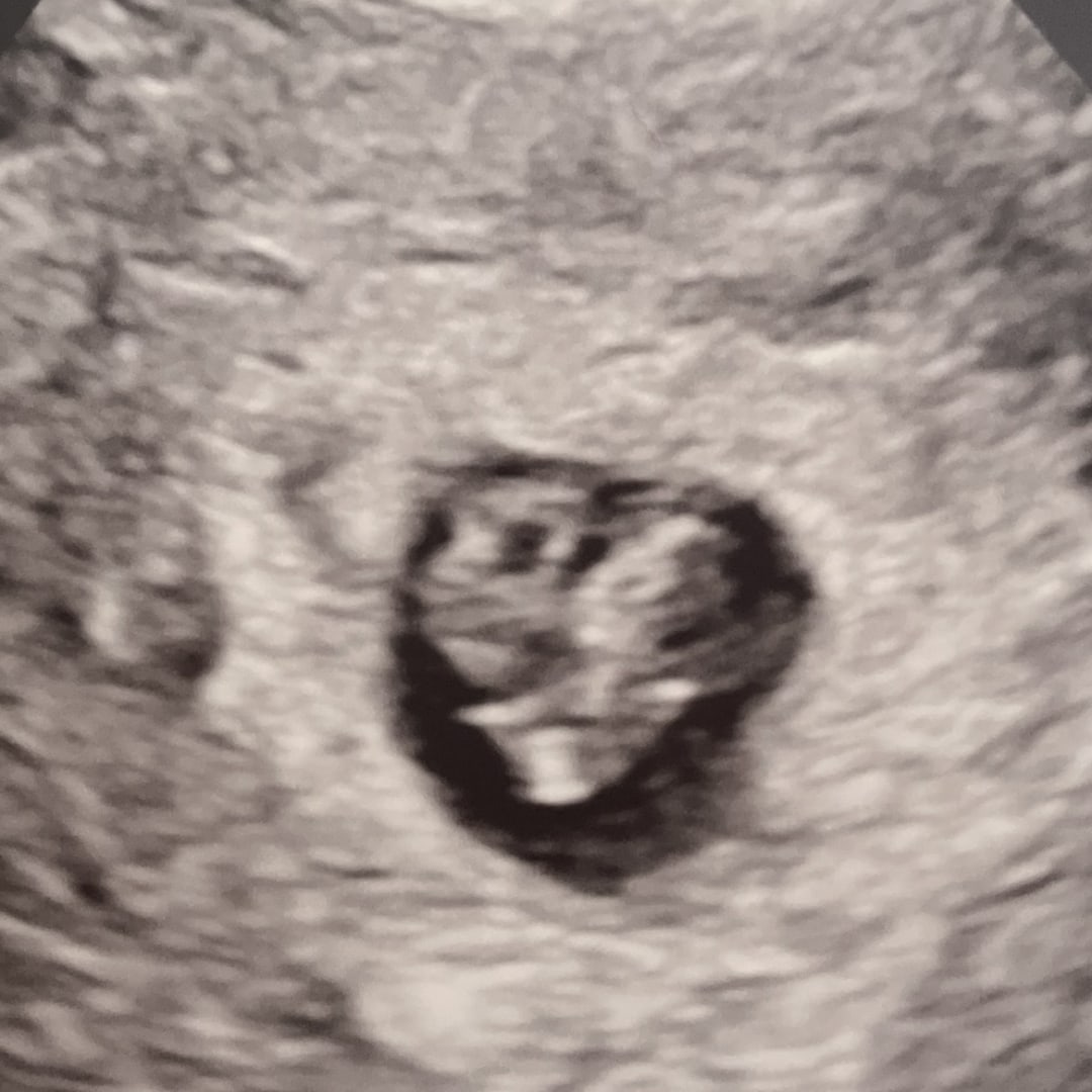 Photo shared by Erika for their Babylist baby registry.