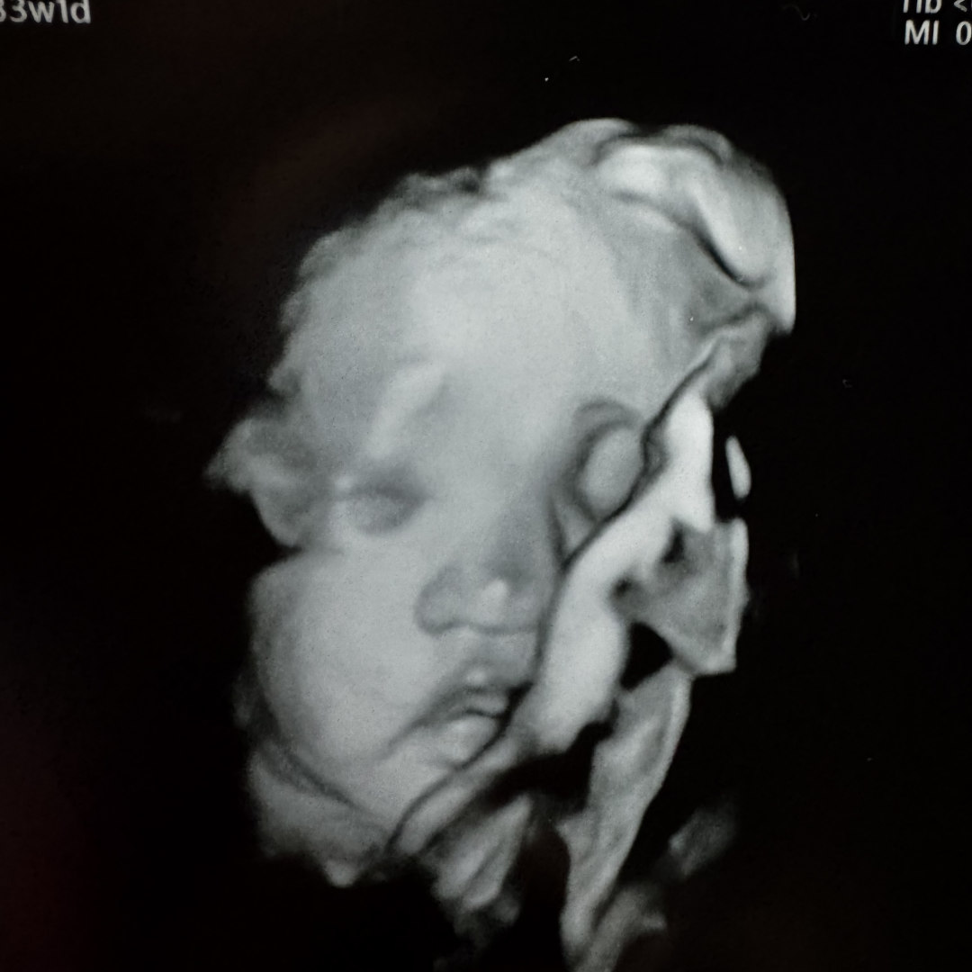 Photo shared by Katrina for their Babylist baby registry.