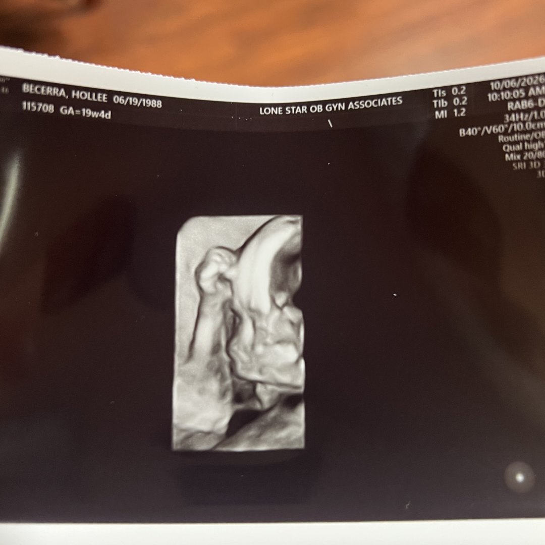 Photo shared by Hollee for their Babylist baby registry.
