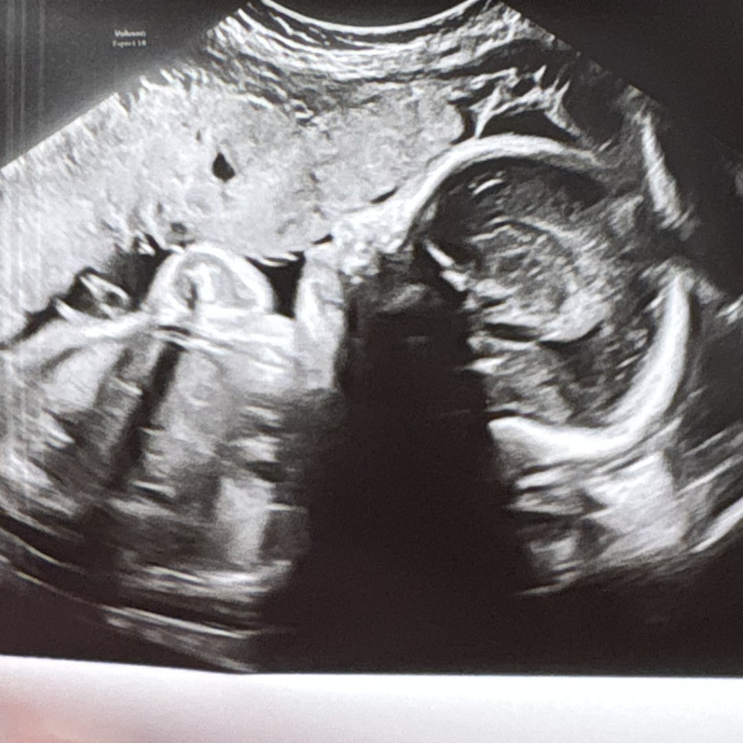 Photo shared by Megan for their Babylist baby registry.