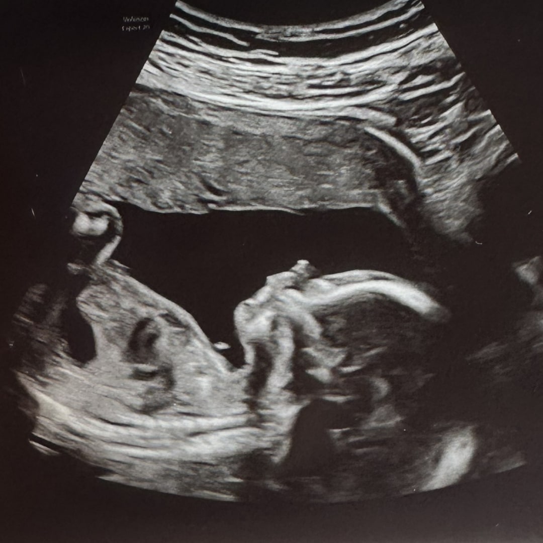 Photo shared by Casey for their Babylist baby registry.