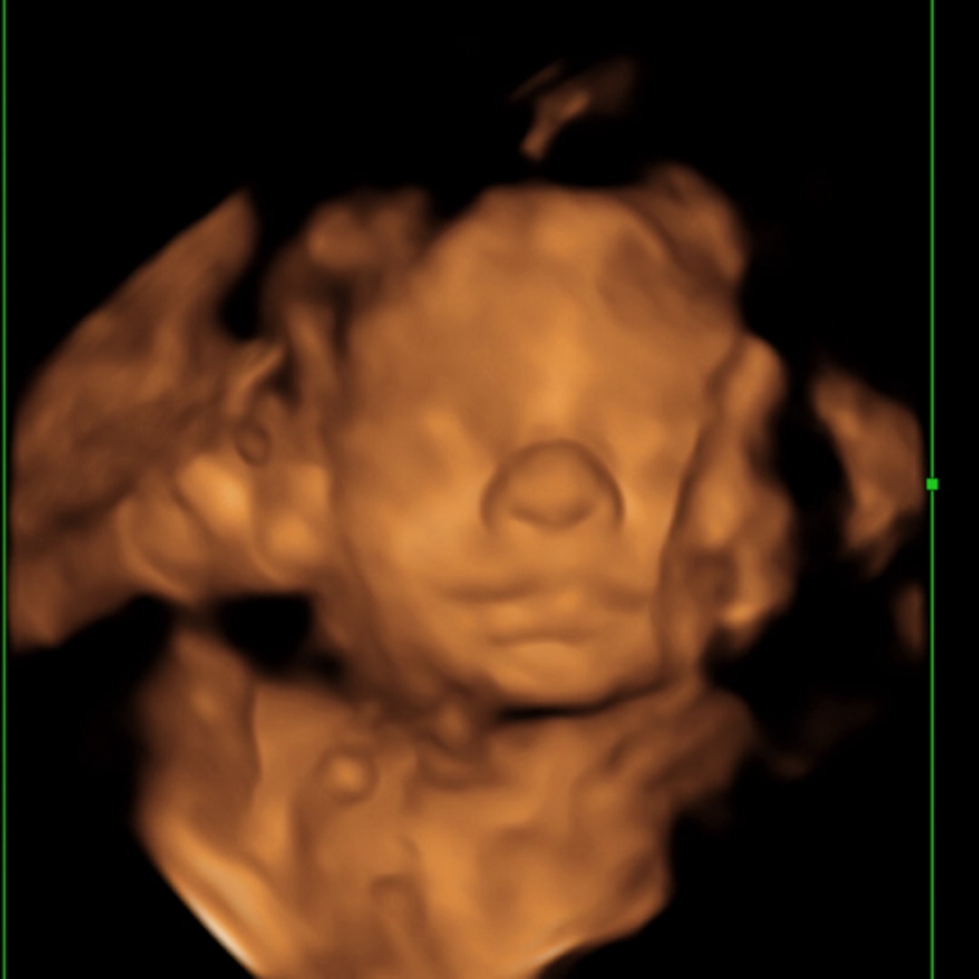 Photo shared by Jan for their Babylist baby registry.