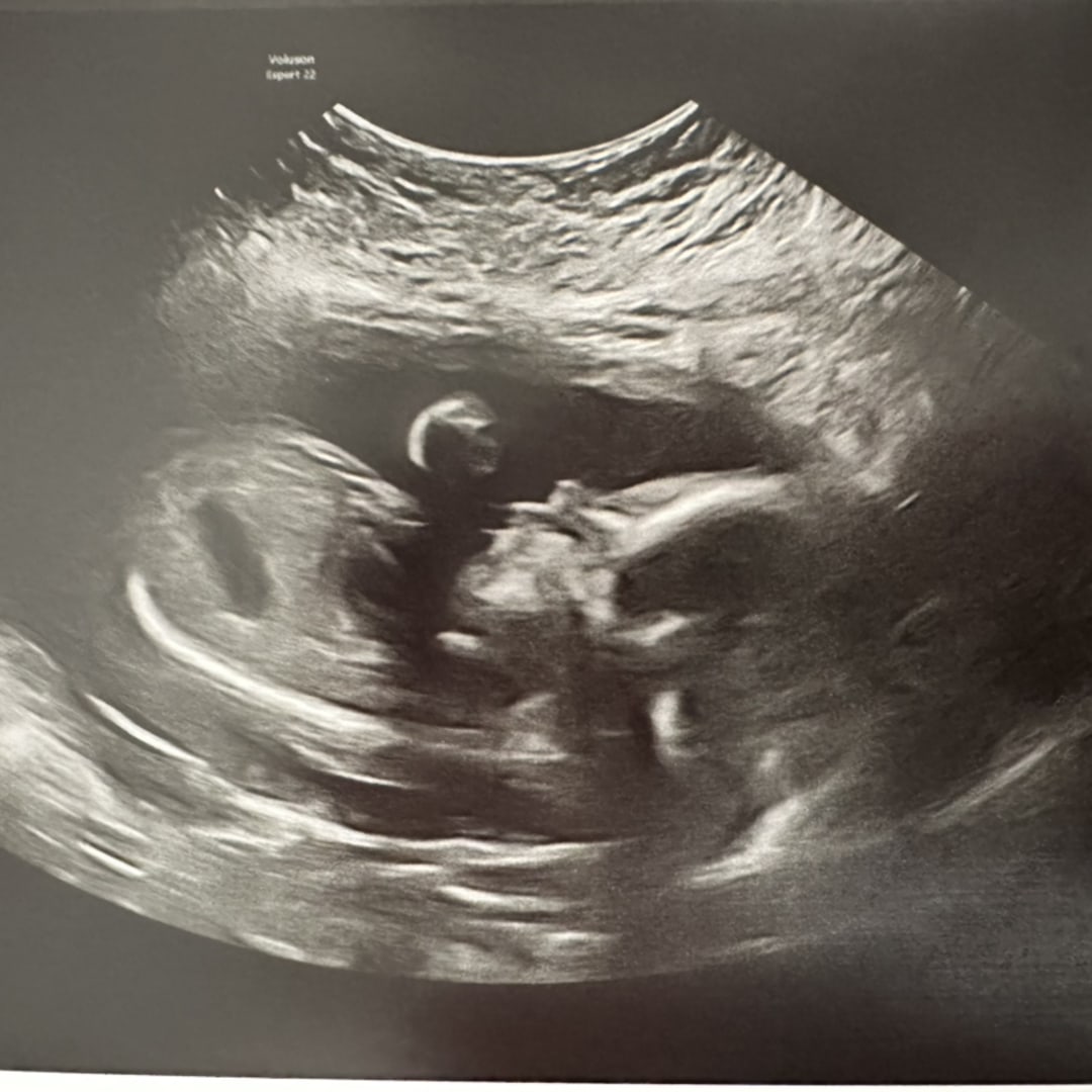 Photo shared by Vee for their Babylist baby registry.