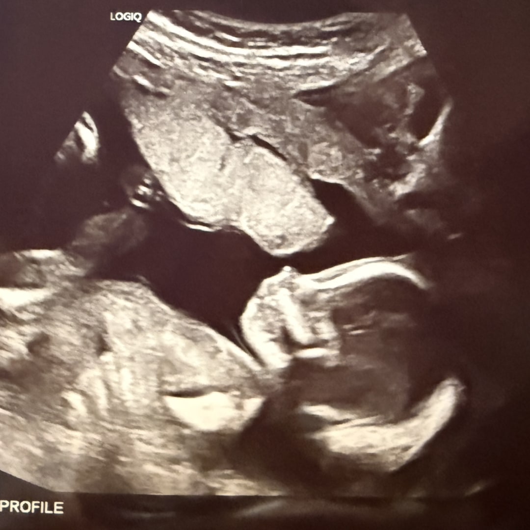 Photo shared by Julia for their Babylist baby registry.