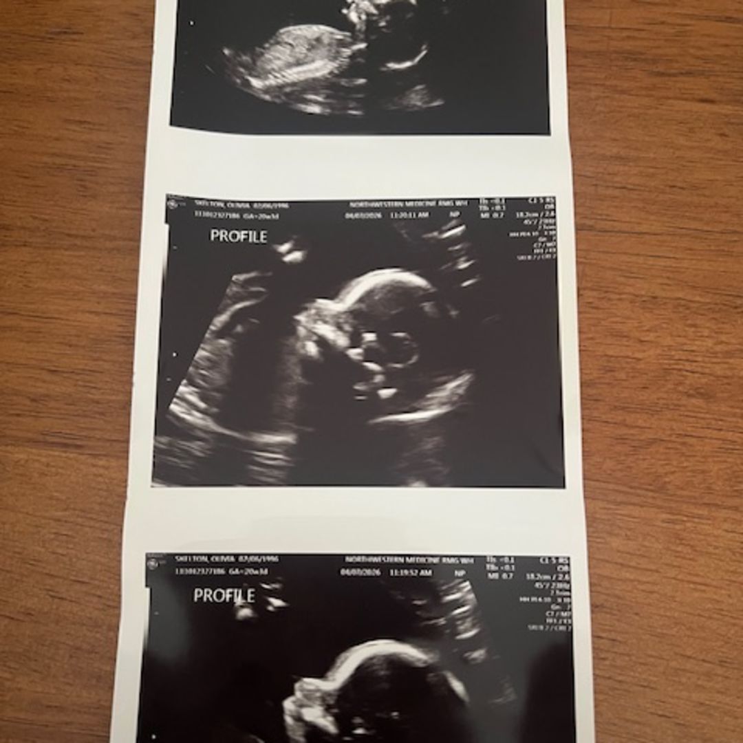 Photo shared by Olivia for their Babylist baby registry.