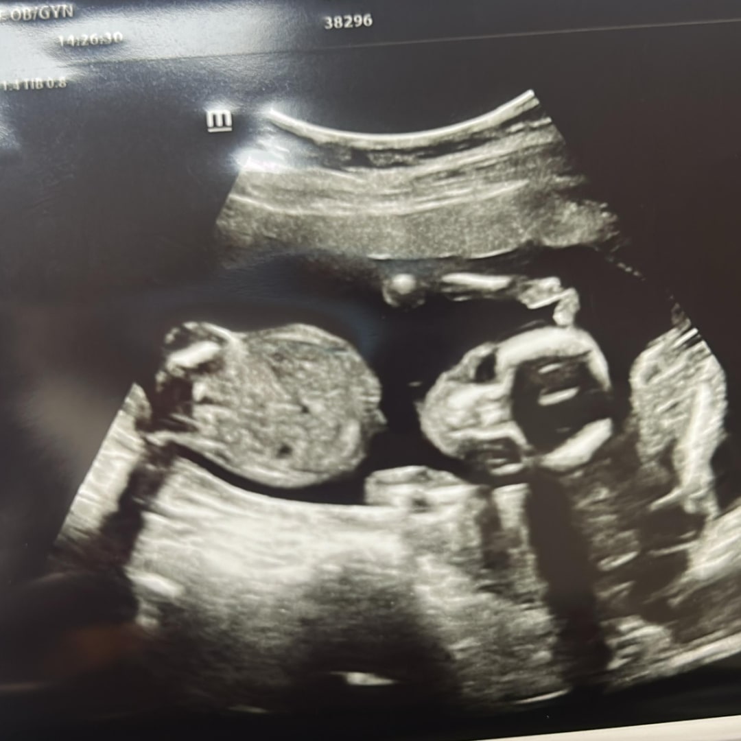 Photo shared by Kayla for their Babylist baby registry.