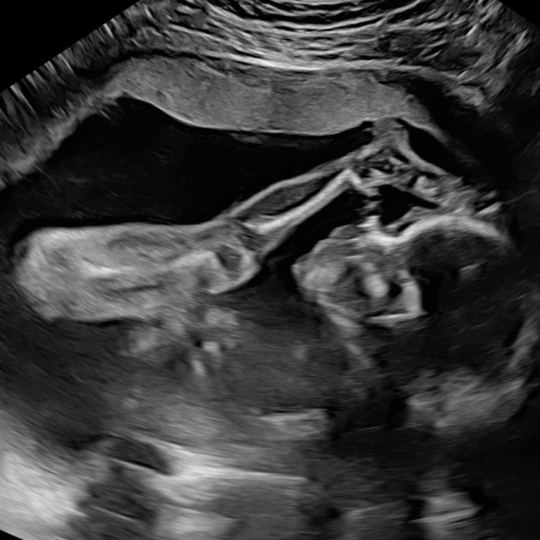 Photo shared by Payton for their Babylist baby registry.