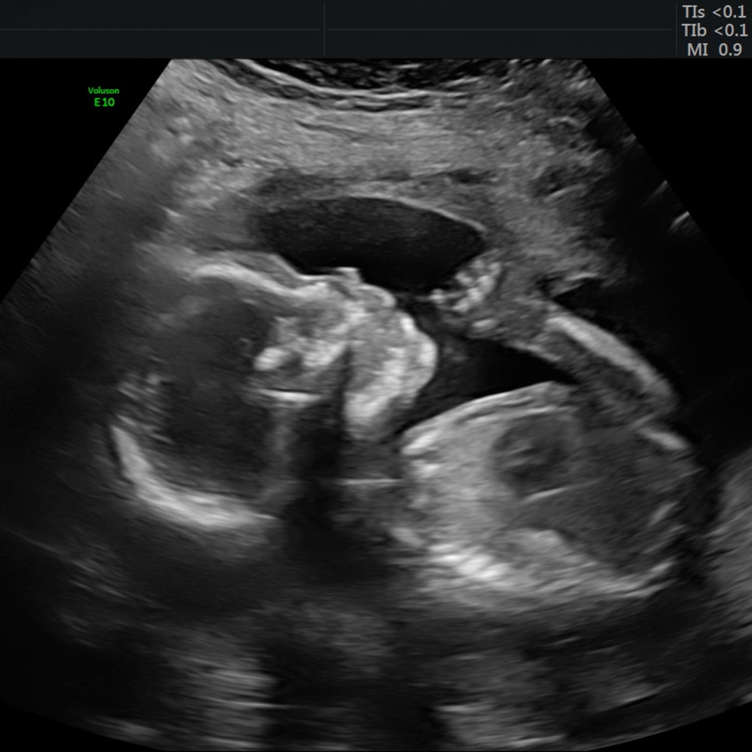 Photo shared by Hannah for their Babylist baby registry.