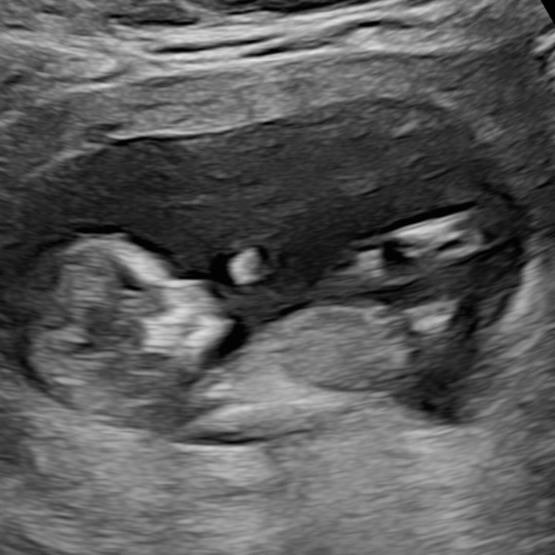 Photo shared by Rebekah for their Babylist baby registry.