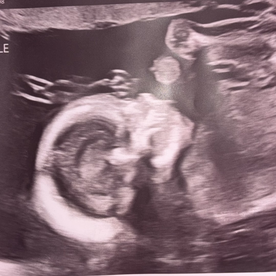Photo shared by Brooke for their Babylist baby registry.