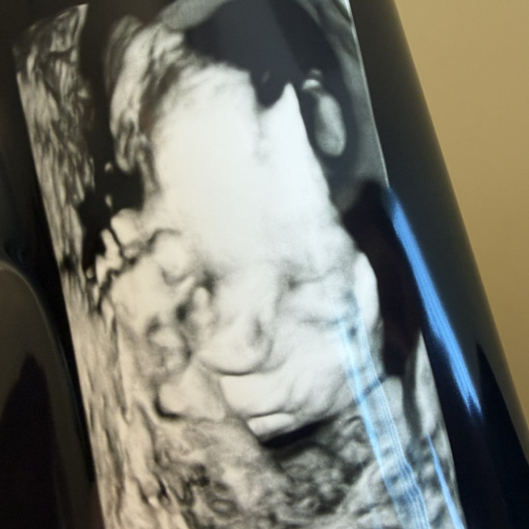 Photo shared by Bethany for their Babylist baby registry.