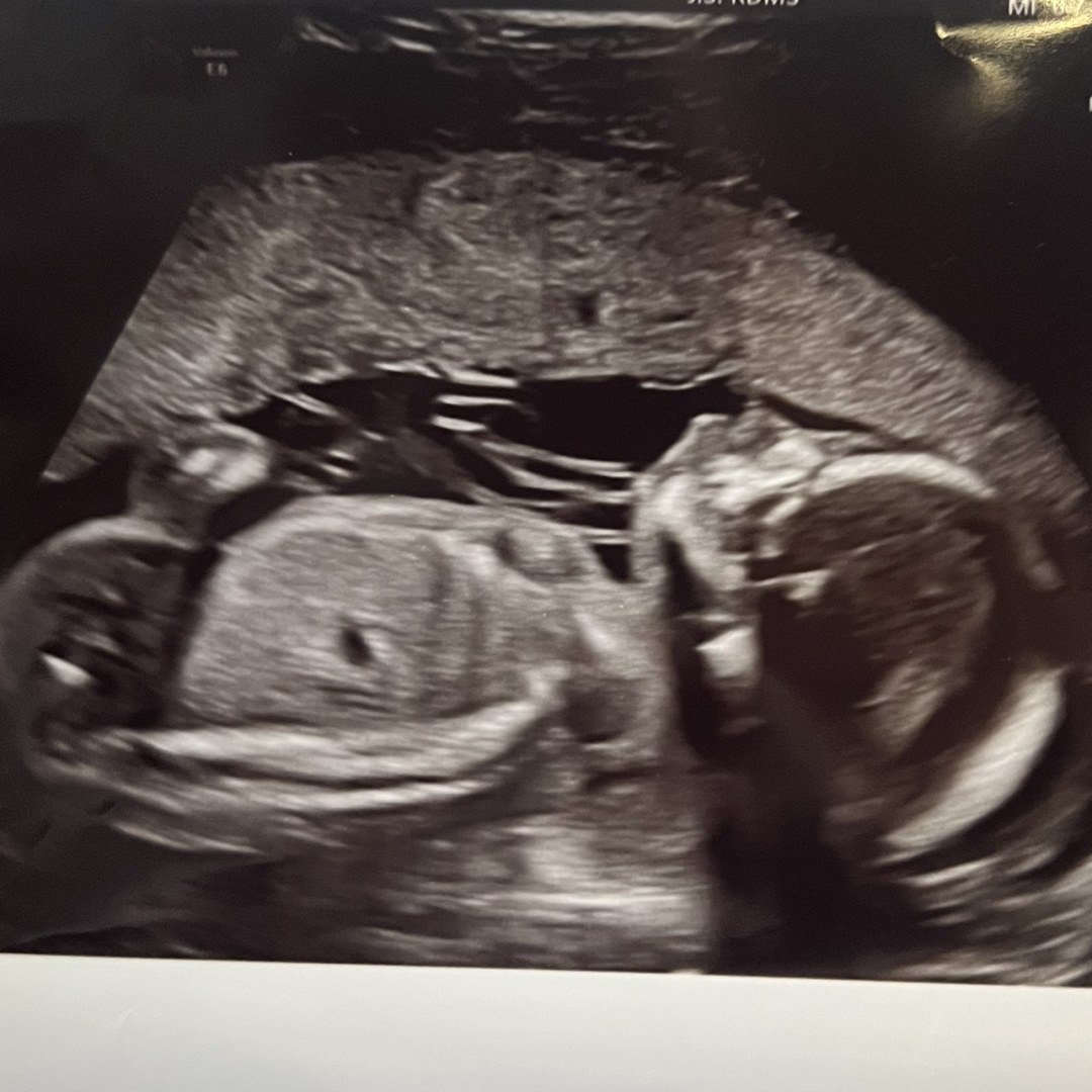 Photo shared by Kathleen for their Babylist baby registry.