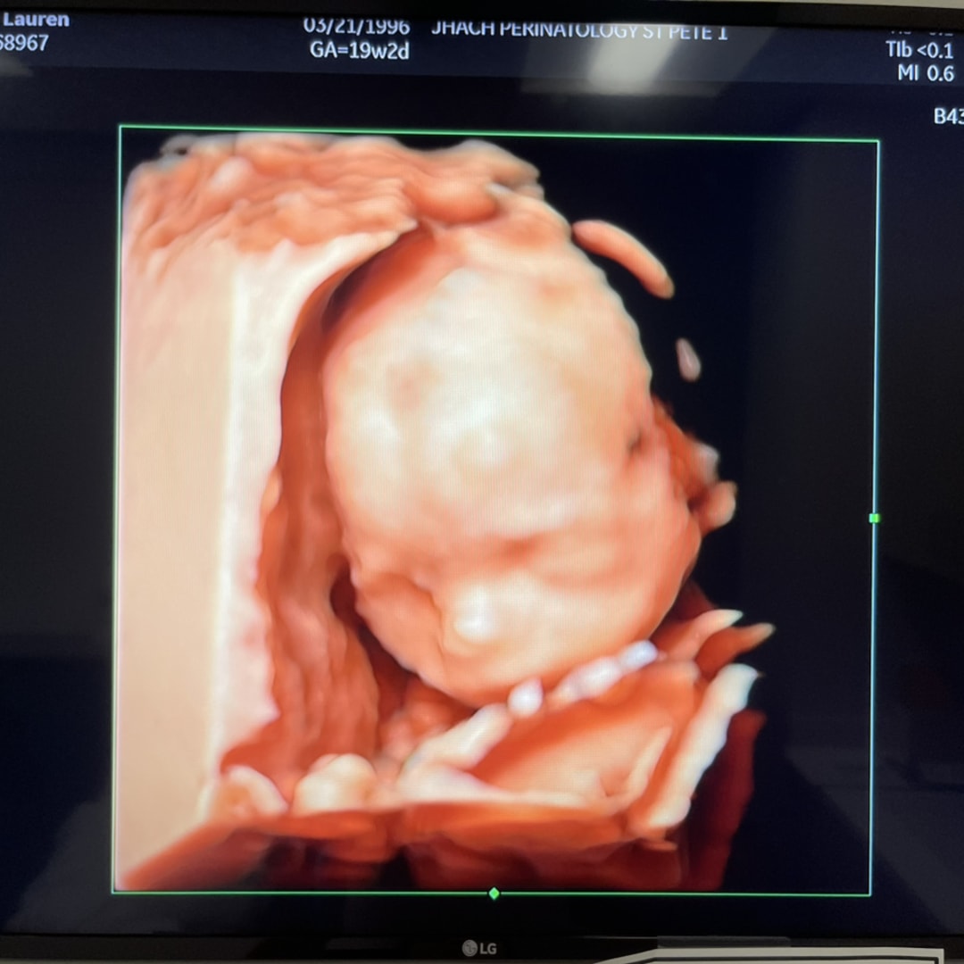 Photo shared by Lauren for their Babylist baby registry.