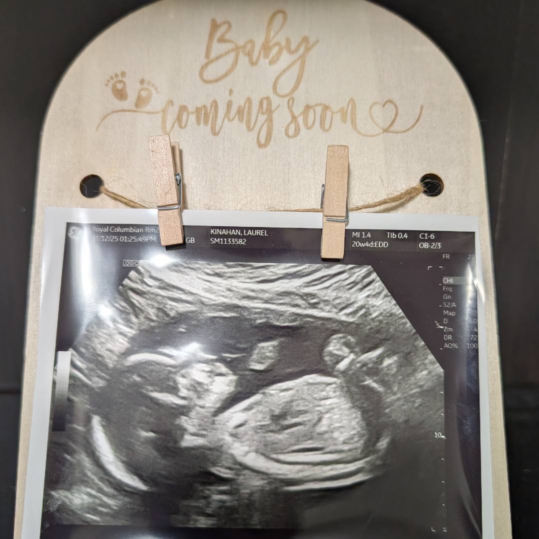 Photo shared by Laurel for their Babylist baby registry.