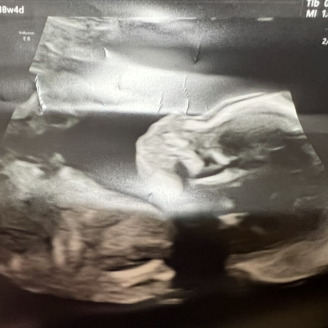 Photo shared by Leah for their Babylist baby registry.