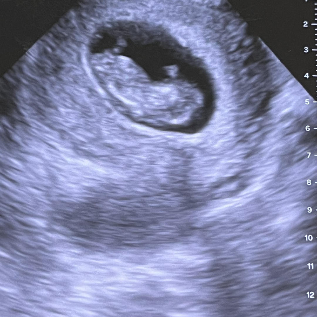 Photo shared by Shadalyn for their Babylist baby registry.