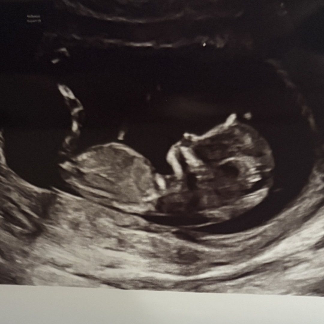 Photo shared by Marissa for their Babylist baby registry.