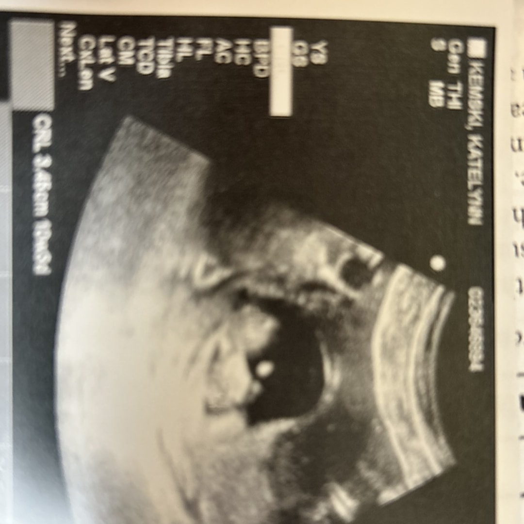 Photo shared by Katelynn for their Babylist baby registry.