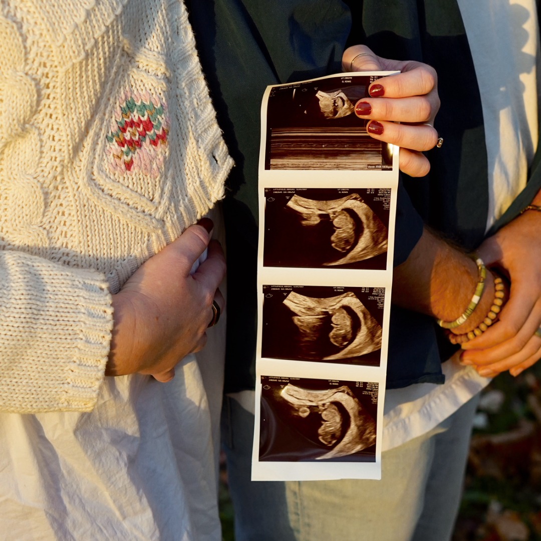 Photo shared by Abby for their Babylist baby registry.