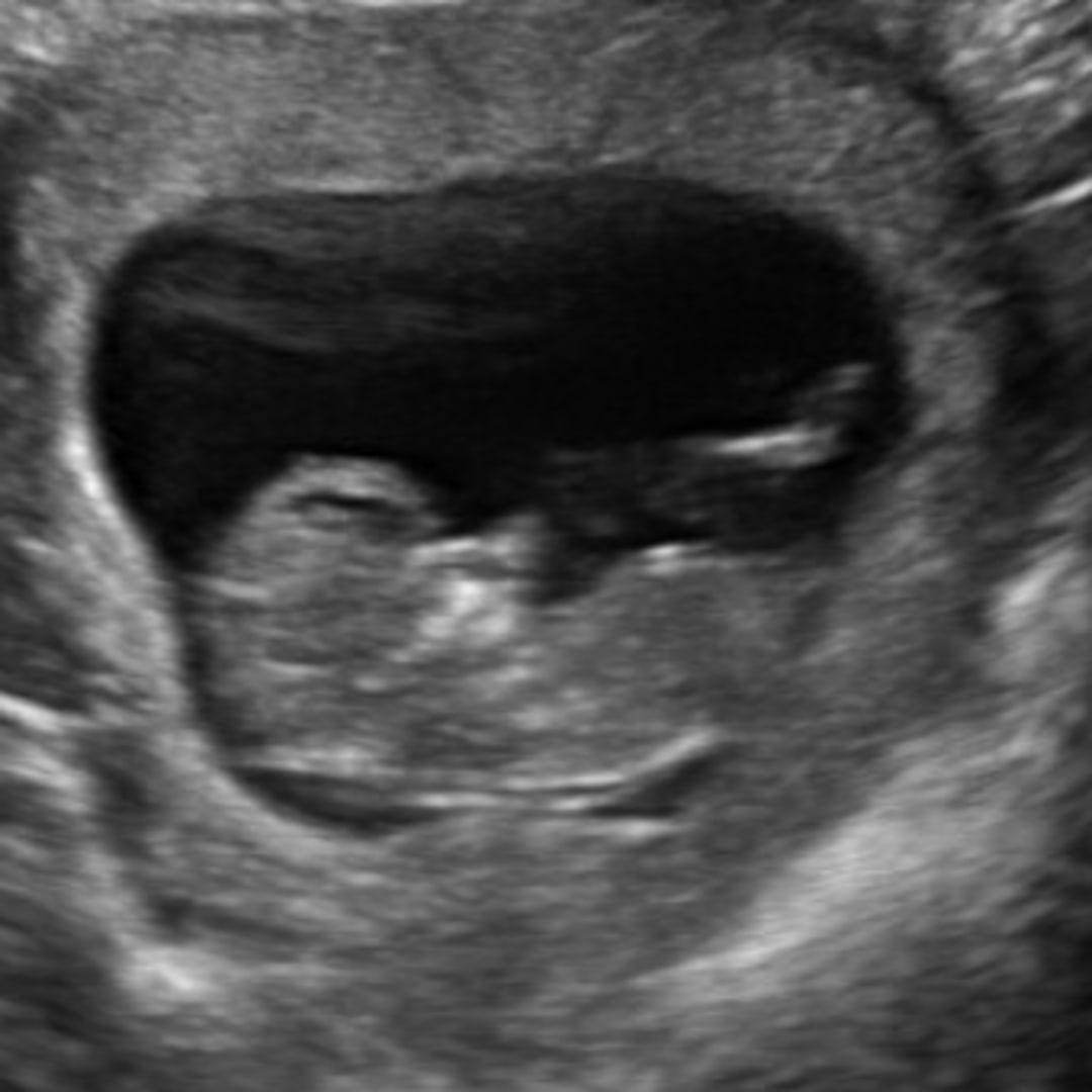 Photo shared by Amira for their Babylist baby registry.