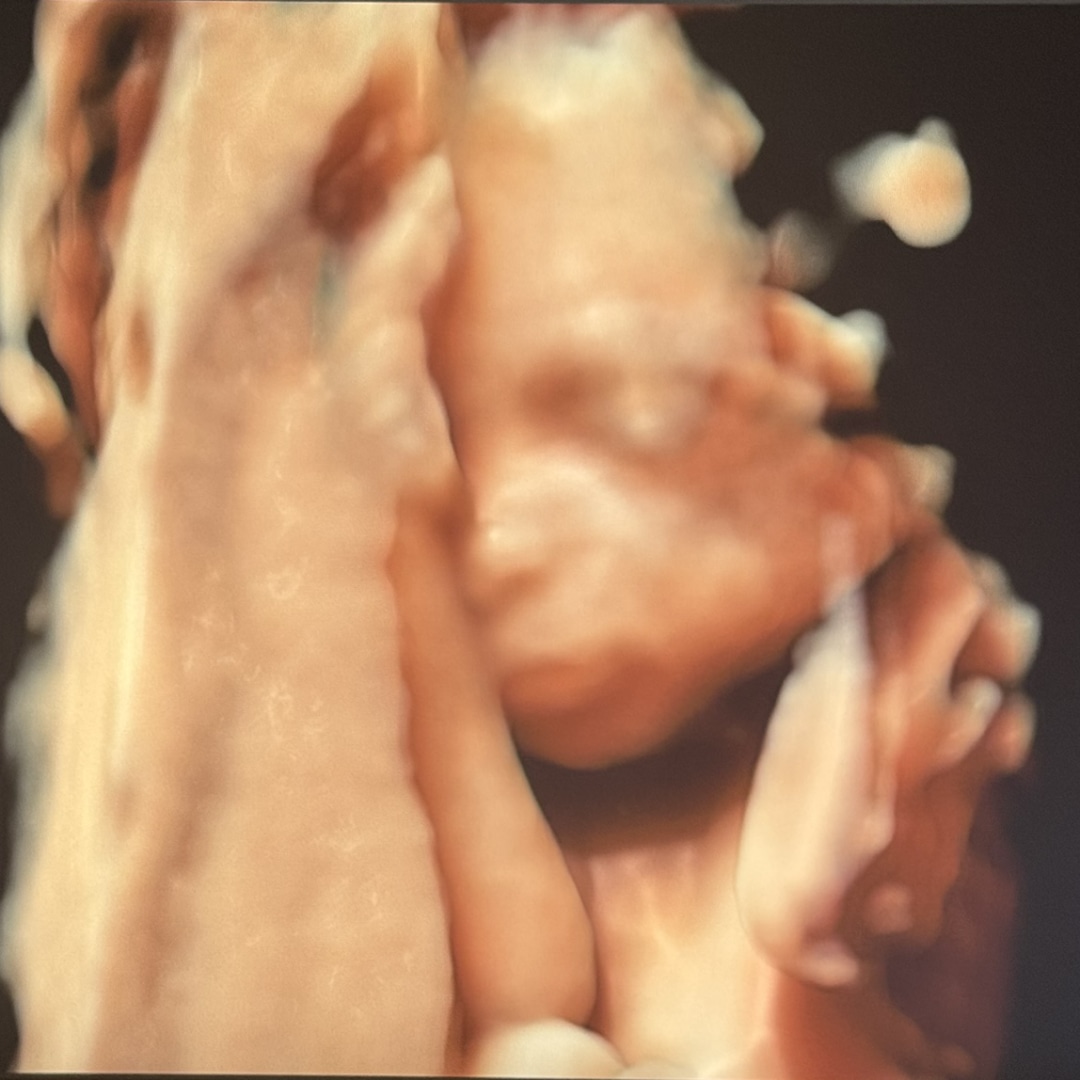 Photo shared by Allie for their Babylist baby registry.