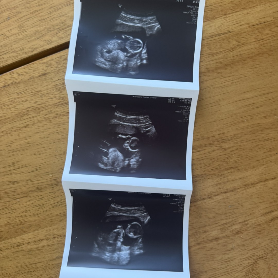 Photo shared by Sara for their Babylist baby registry.