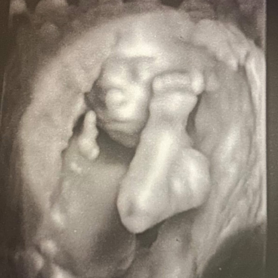 Photo shared by Amy for their Babylist baby registry.