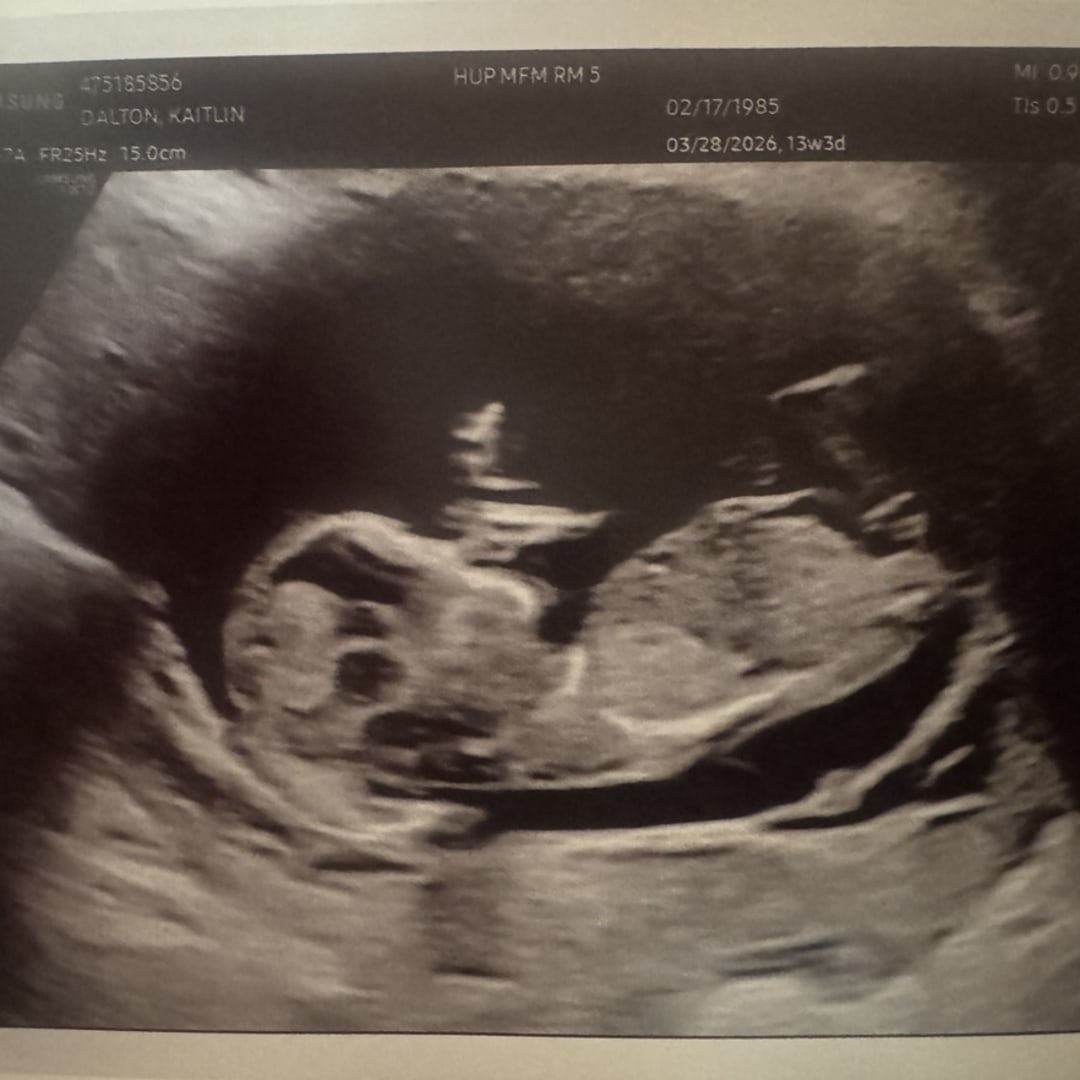 Photo shared by Katy for their Babylist baby registry.