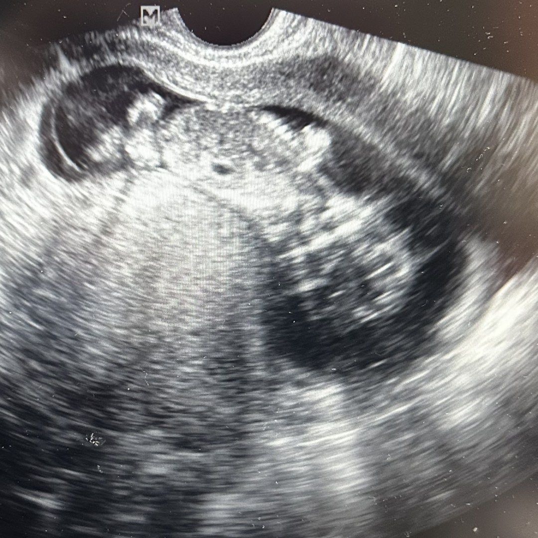 Photo shared by Kaila for their Babylist baby registry.