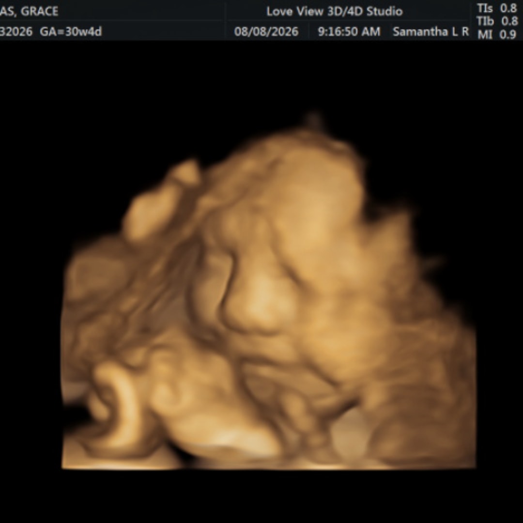 Photo shared by Grace for their Babylist baby registry.