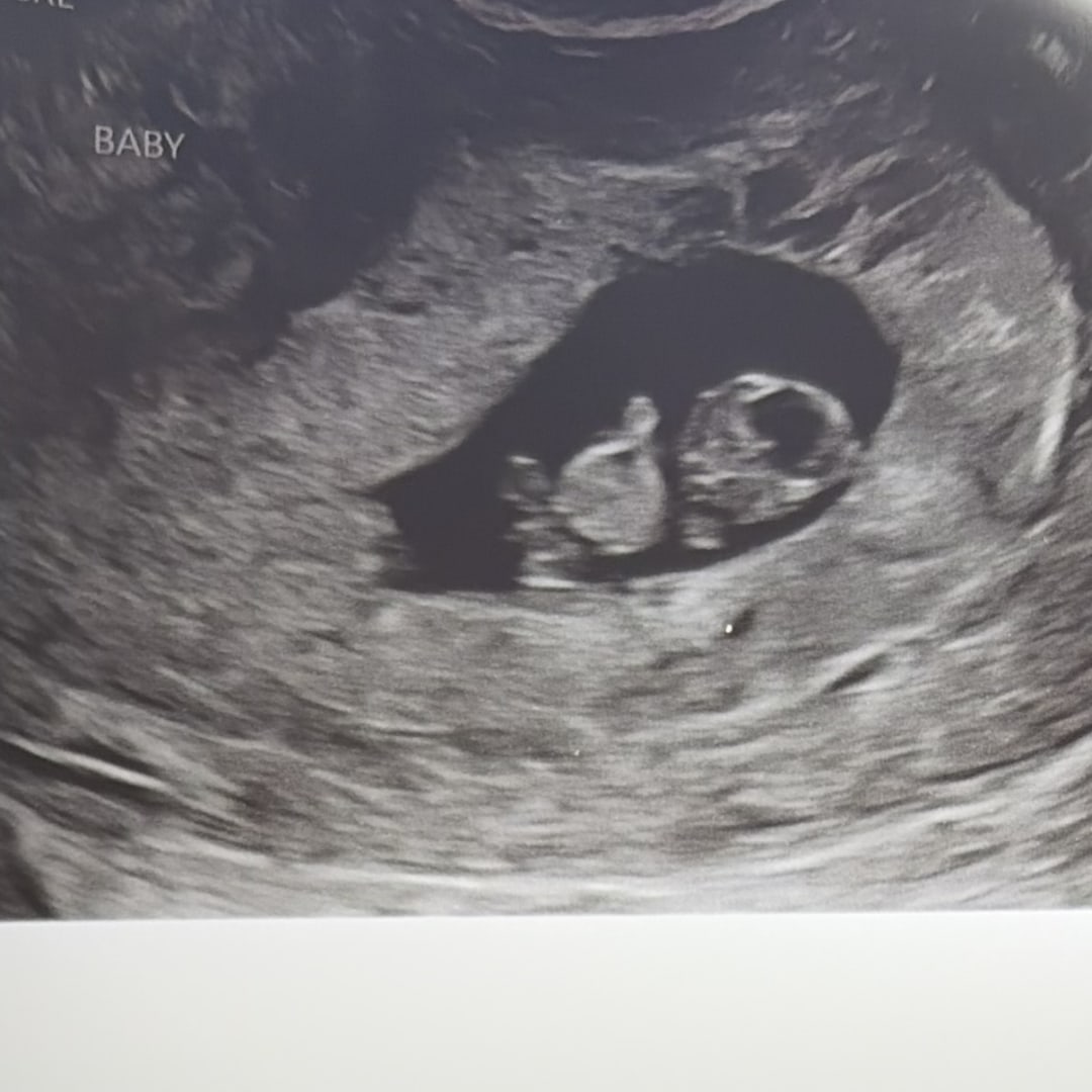 Photo shared by Samantha for their Babylist baby registry.