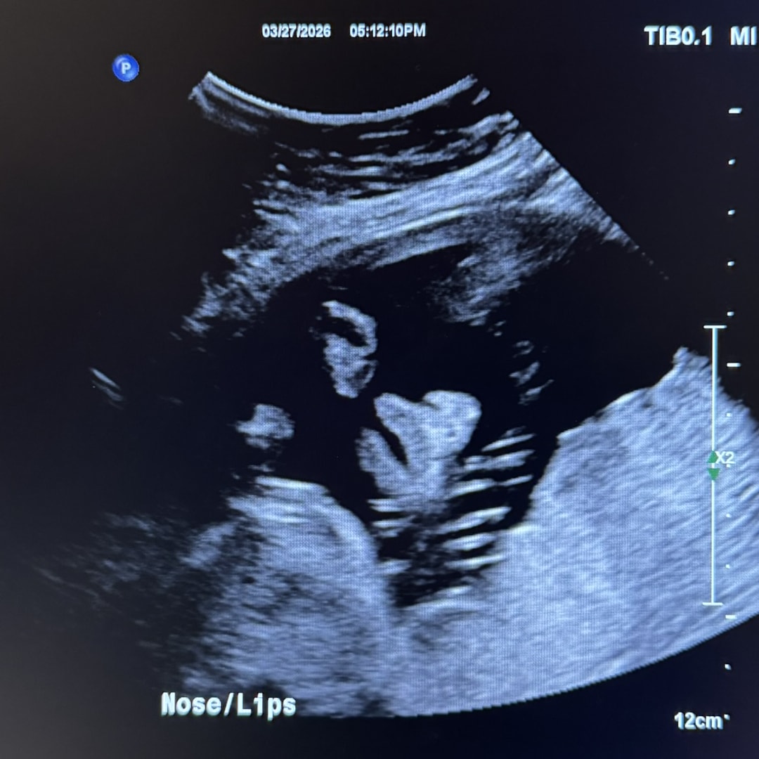 Photo shared by Hallie for their Babylist baby registry.