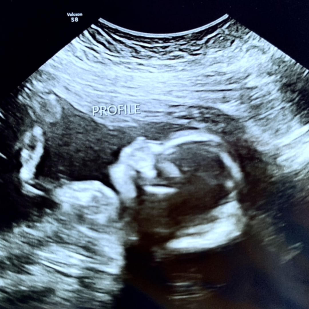 Photo shared by Reagan for their Babylist baby registry.