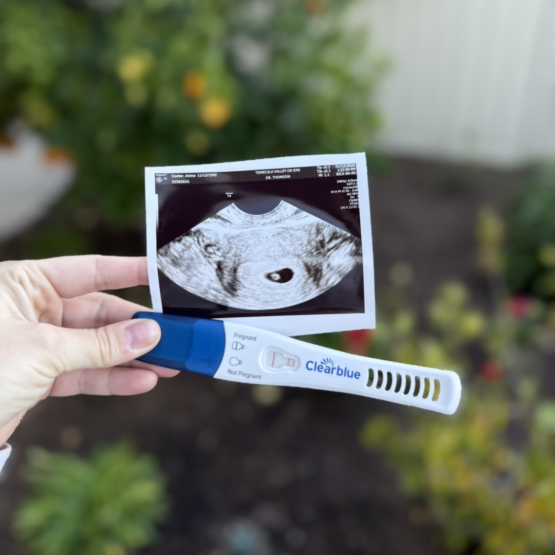 Photo shared by Anina for their Babylist baby registry.