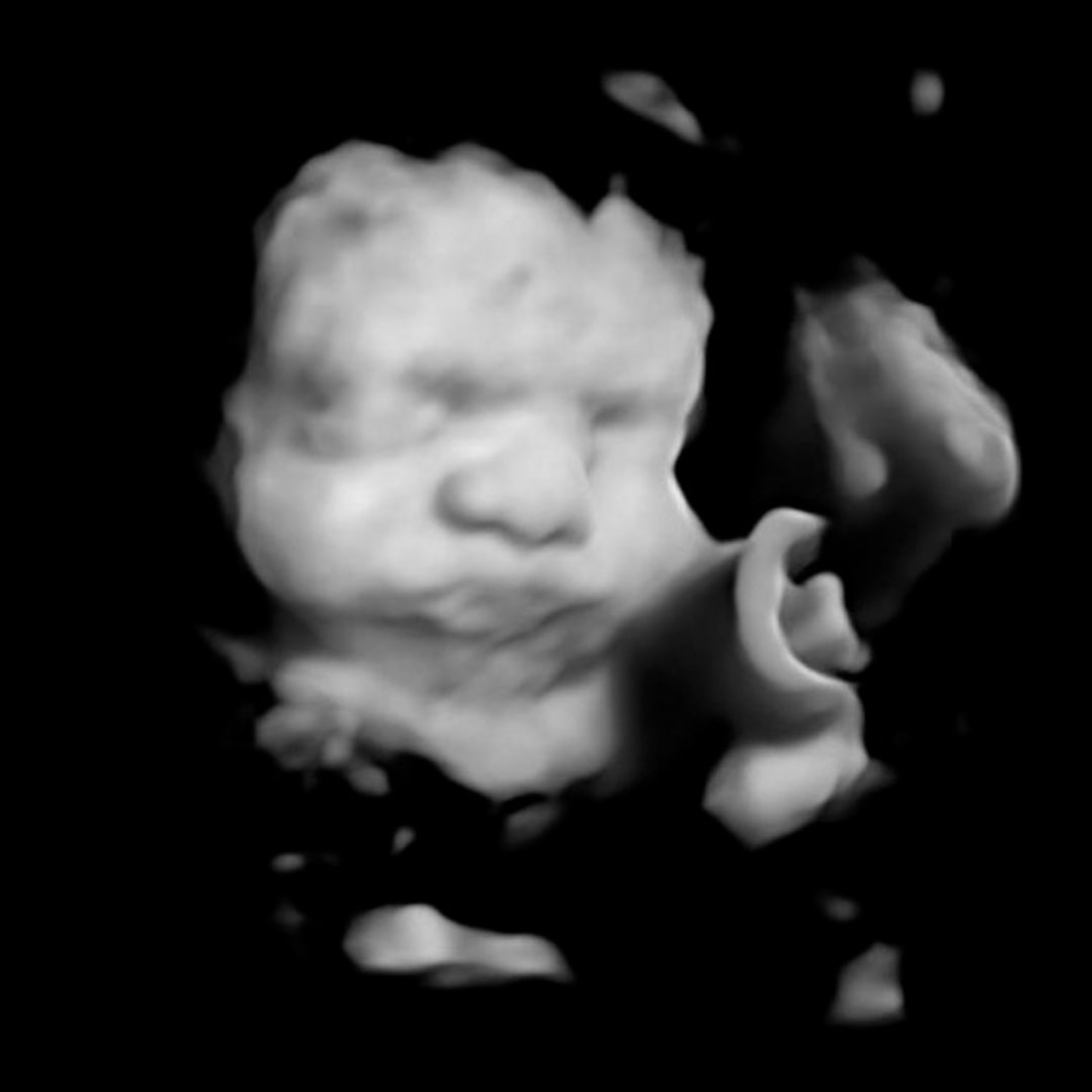 Photo shared by Shelby for their Babylist baby registry.