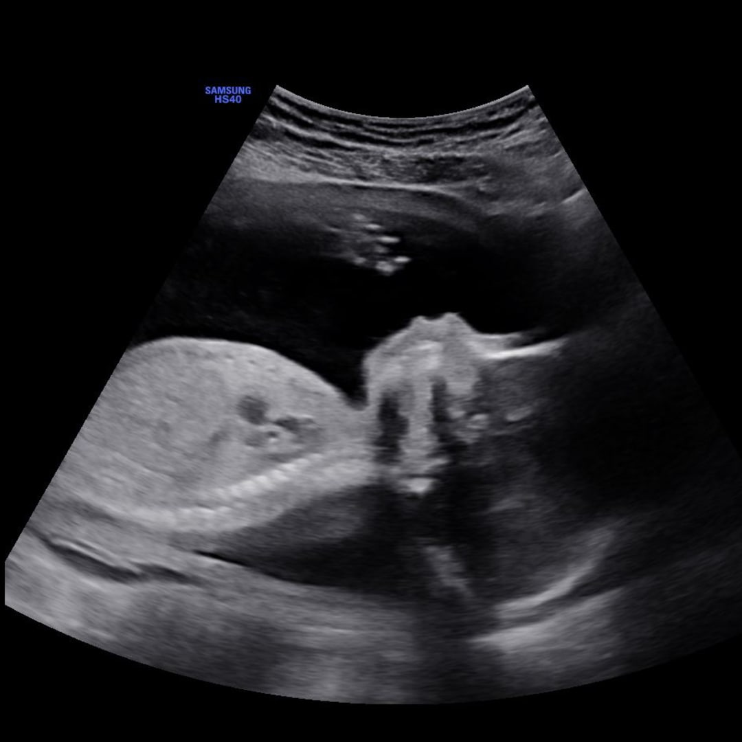 Photo shared by Ruth for their Babylist baby registry.