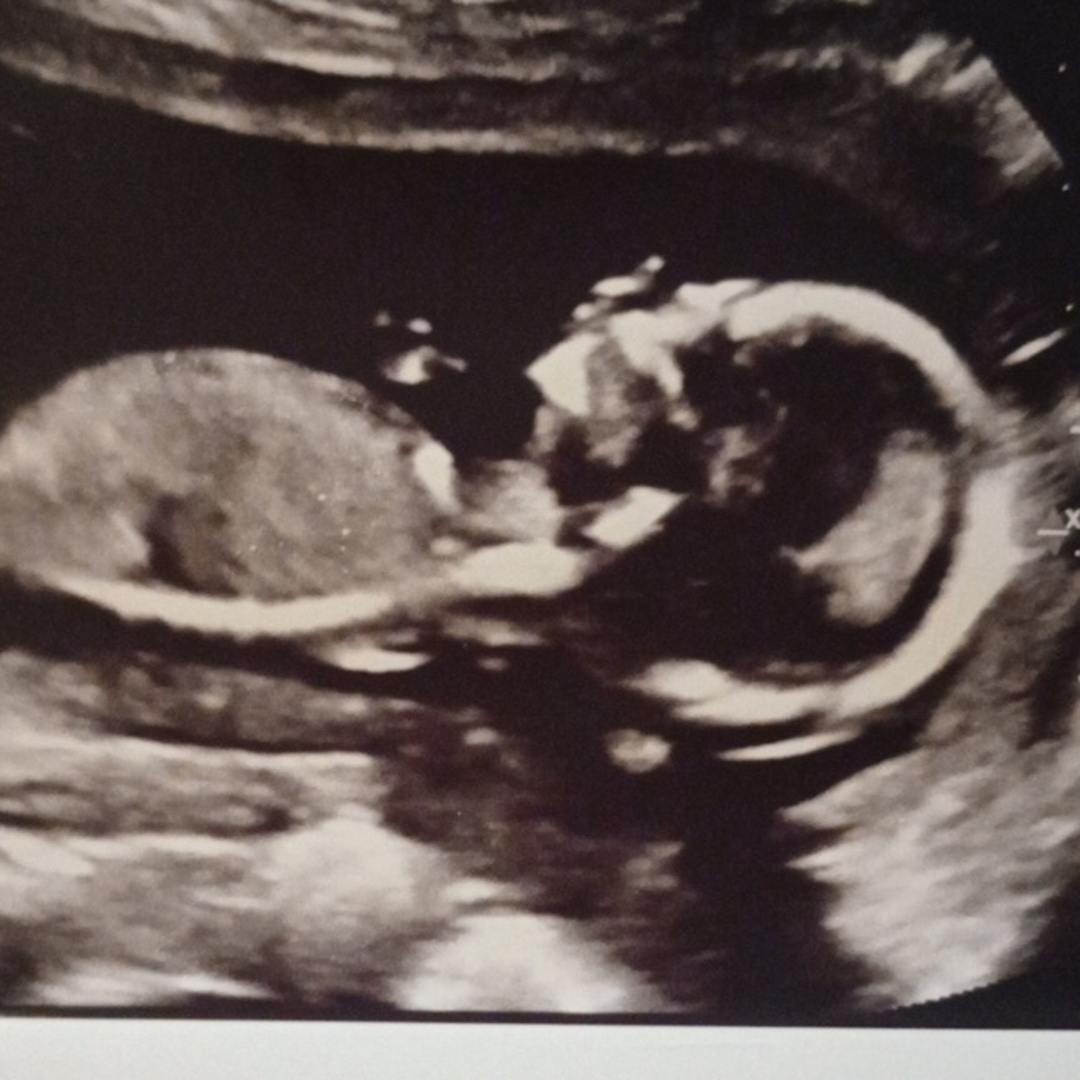 Photo shared by Sabrina for their Babylist baby registry.