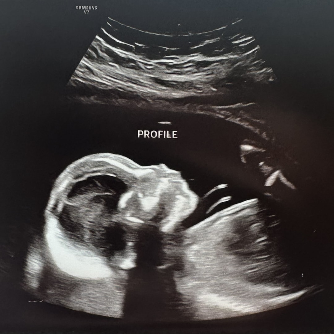 Photo shared by Hannah for their Babylist baby registry.