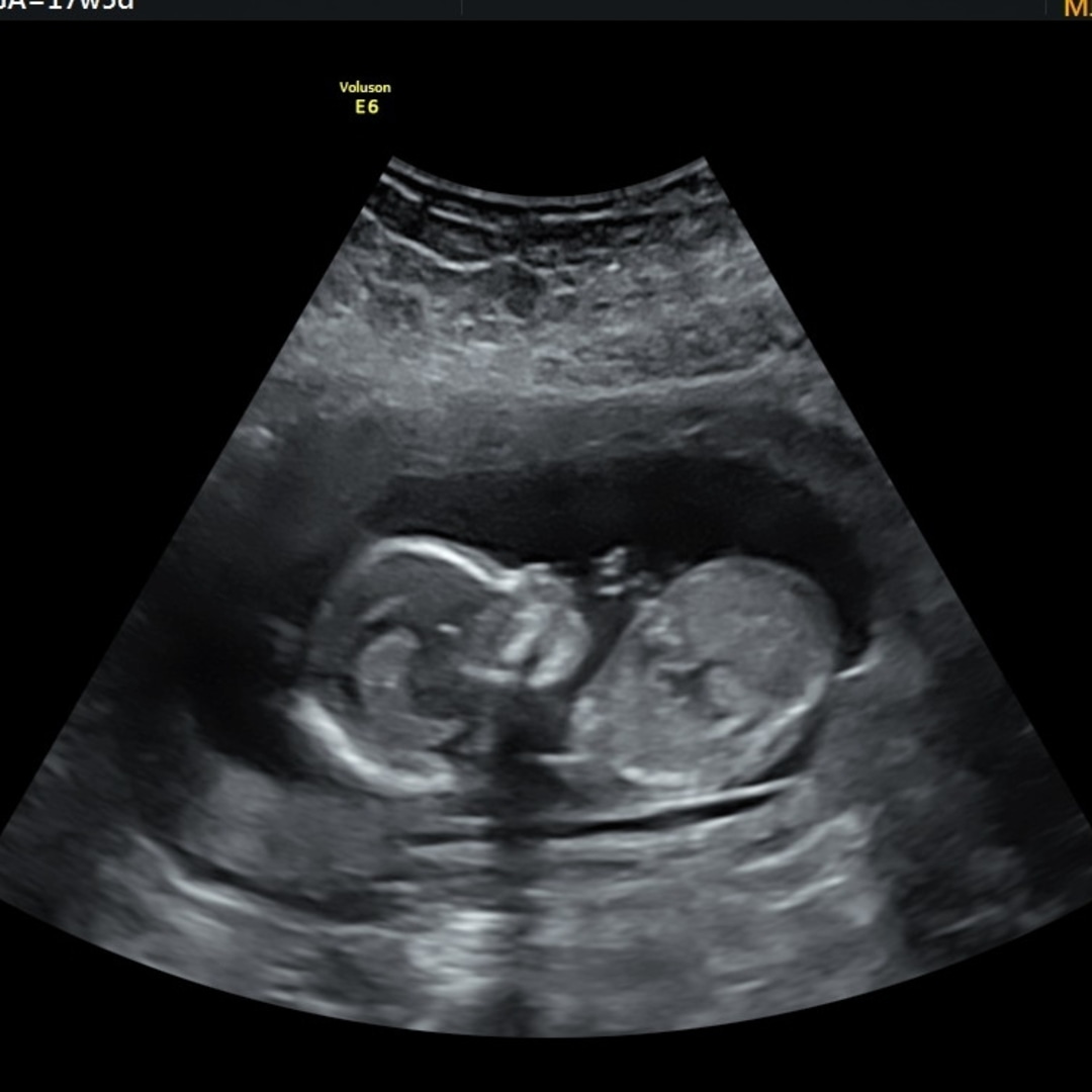 Photo shared by Dahlyn for their Babylist baby registry.