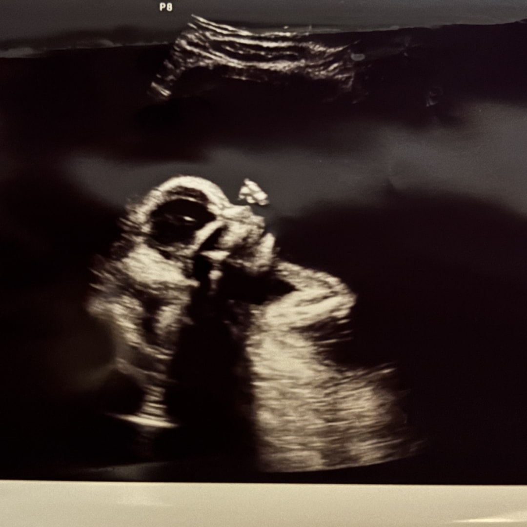 Photo shared by Cortney for their Babylist baby registry.