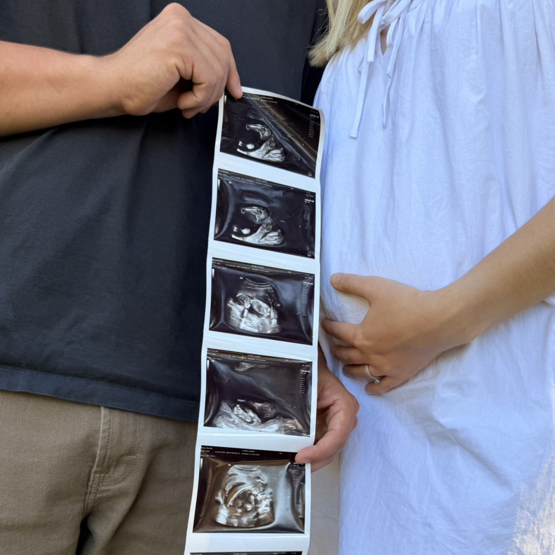 Photo shared by Lauren for their Babylist baby registry.