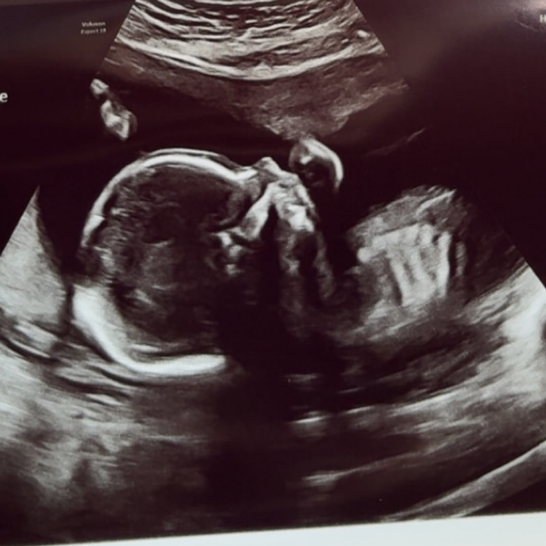 Photo shared by Ariel for their Babylist baby registry.