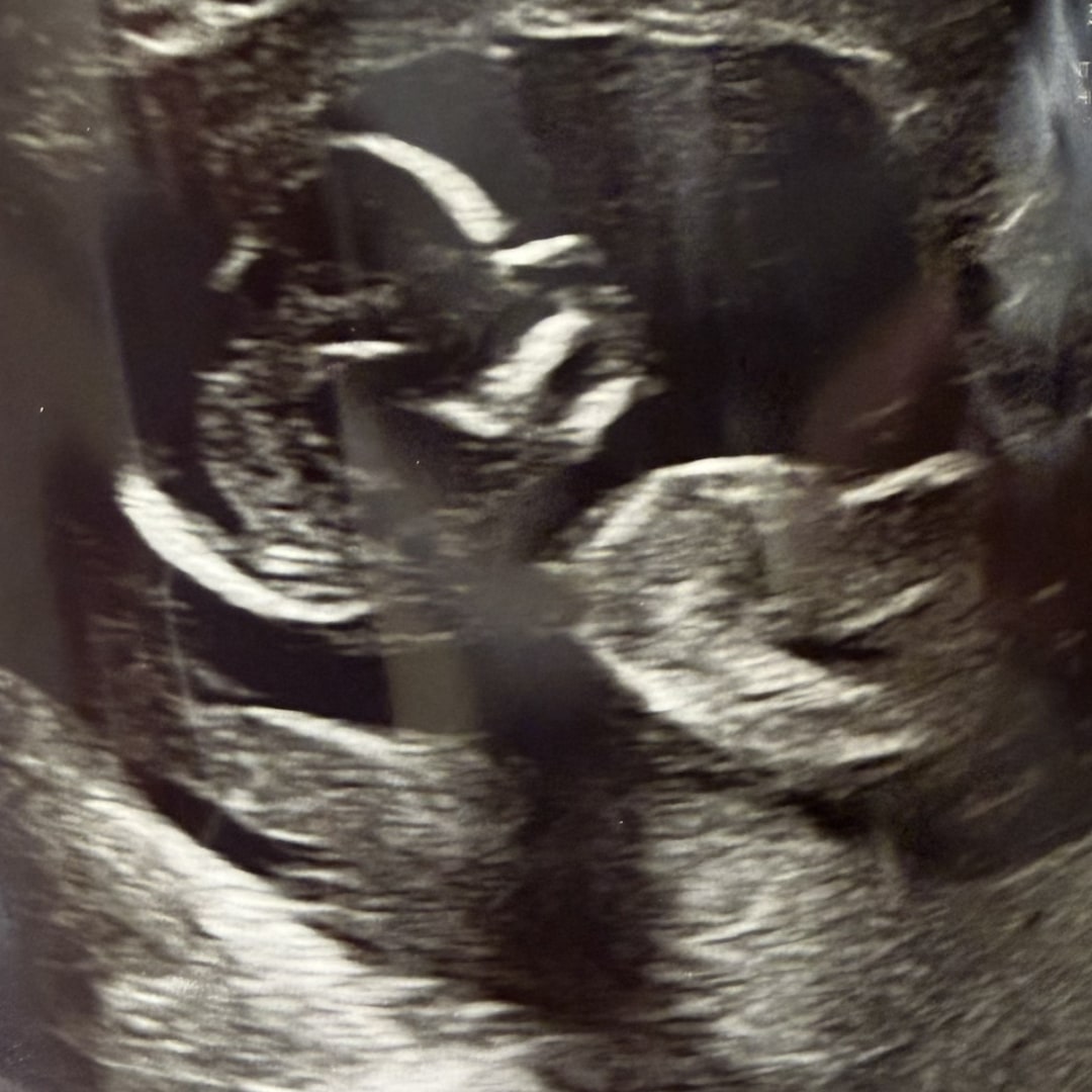Photo shared by Sarah for their Babylist baby registry.