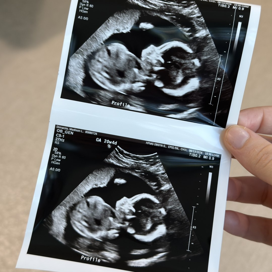 Photo shared by Madison for their Babylist baby registry.