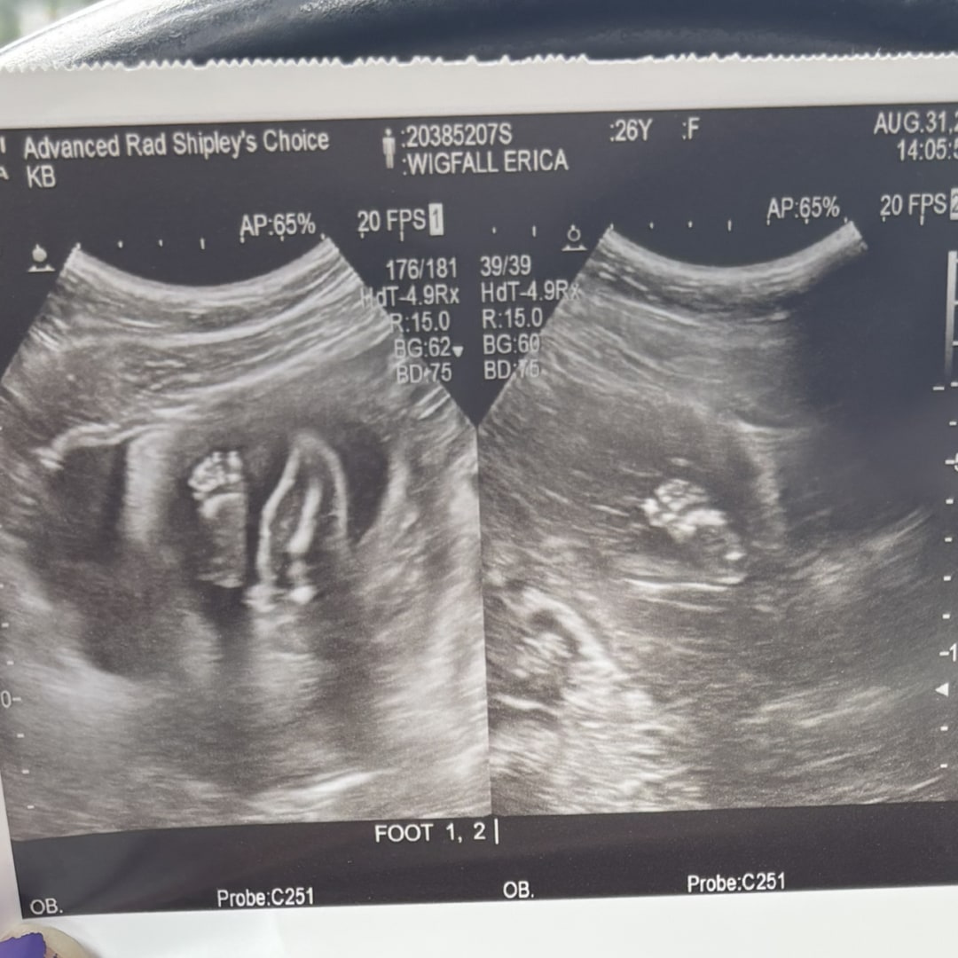 Photo shared by Erica for their Babylist baby registry.